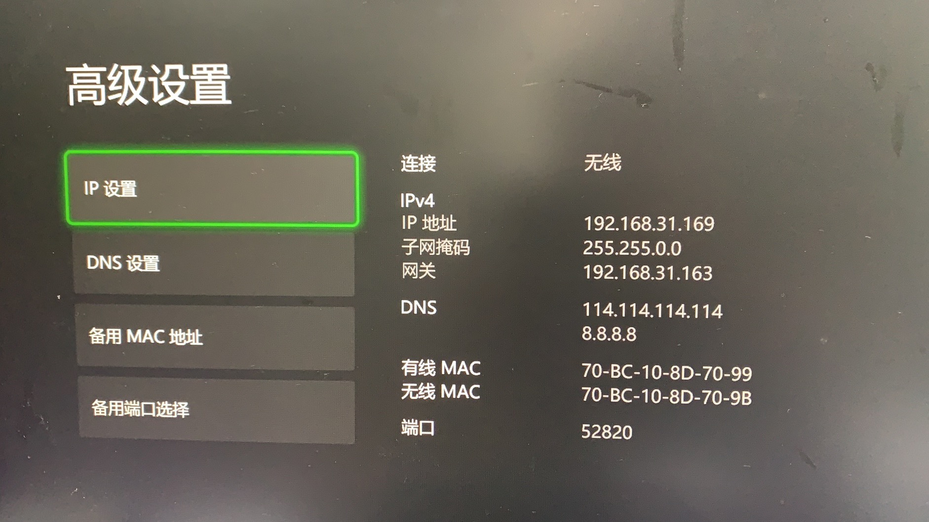 uu主机加速器_加速主机的加速器_uu电脑加速主机
