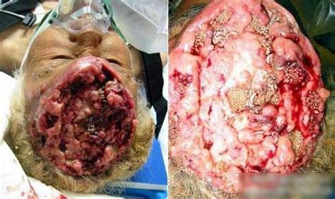 rmvb下载寄生虫_寄生虫迅雷下载_1080p下载寄生虫